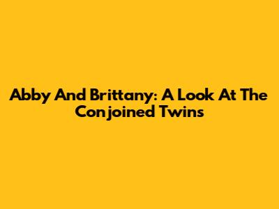 Abby And Brittany: A Look At The Conjoined Twins