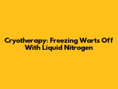Cryotherapy: Freezing Warts Off With Liquid Nitrogen